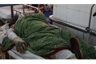 Sad that the husband poured gasoline to burn his wife